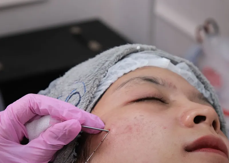 Biostimulation & bio-revitalisation